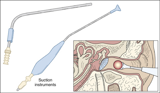 B9780323079099000283 f28 04 9780323079099